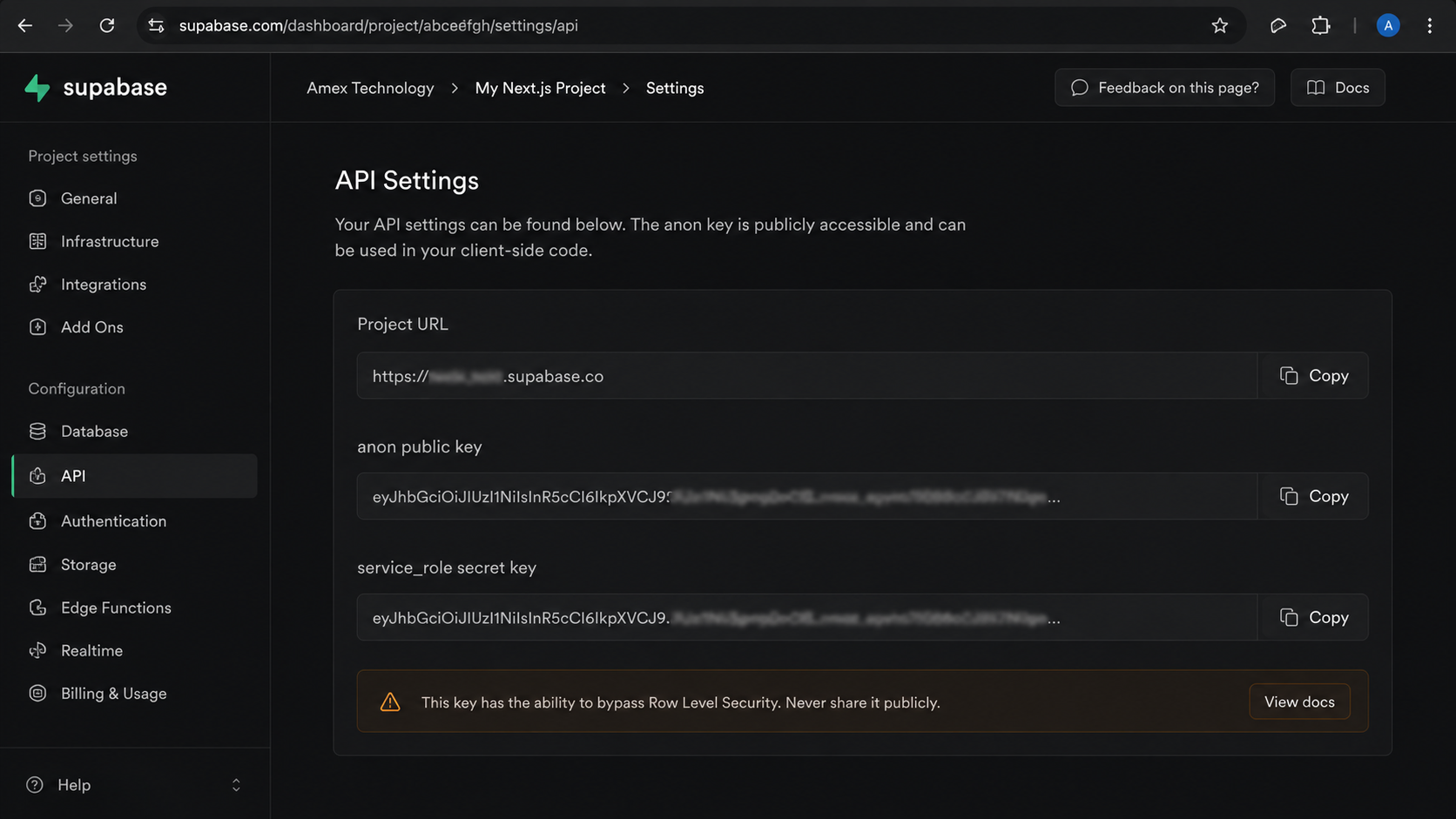Supabase project API Settings showing Project URL, anon public key, and service role key